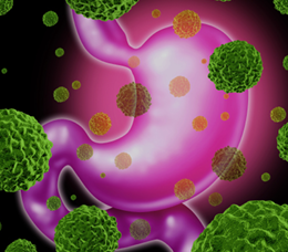 Exploring Treatment Options After Disease Progression in Advanced or Metastatic Gastric/GEJ Adenocarcinoma